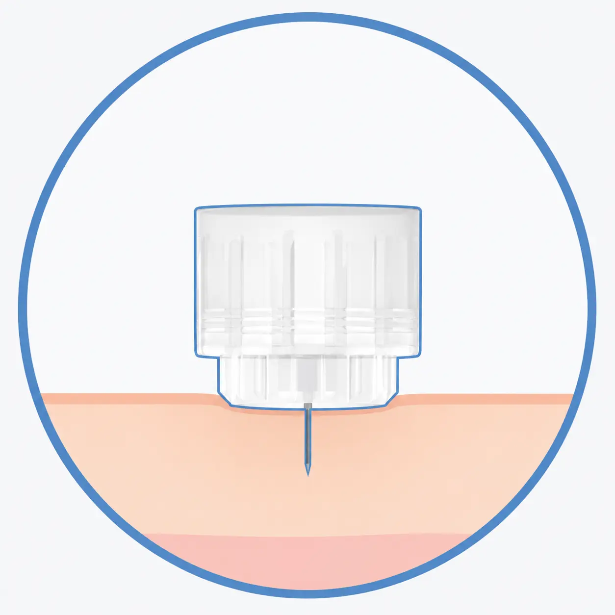 Flat needle base structure on Plus 5-bevel insulin pen needle